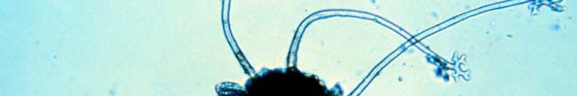 Tάξη: Erysiphales, Oικογένεια:Erysiphaceae Podosphaera sp.