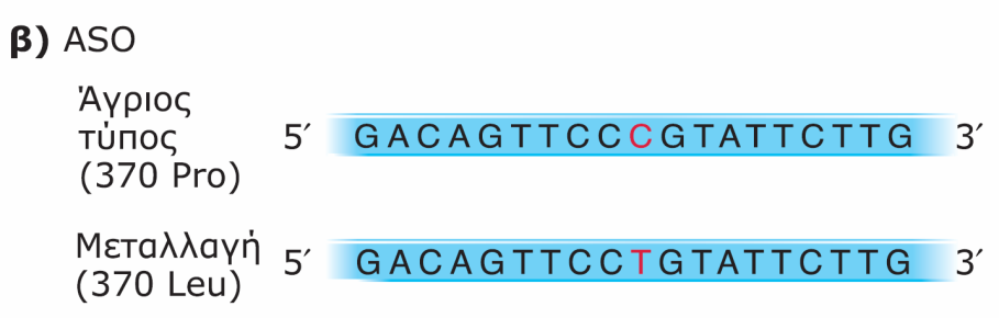 Λόγω της μεταλλα- γής στη θέση 370 του πολυπεπτιδίου, μια Pro μετατρέπεται σε Leu.