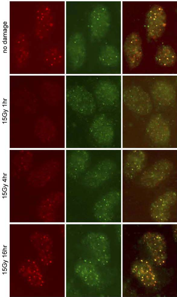 BRCA2 PALB2 MERGE BRCA2 partner Ανοσοφθορισμός σε U2OS κύτταρα (osteosarcoma line) Συνεντοπισμός
