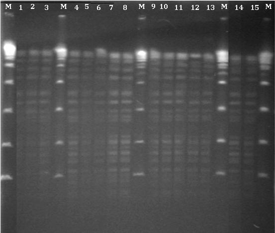 μηχανισμό αντοχής στις καρβαπενέμες, ανιχνεύθηκαν με PCR 2 γονίδια υπεύθυνα για την παραγωγή καρβαπενεμασών της κατηγορίας OXA (Ambler τάξη D) και συγκεκριμένα τα γονίδια bla OXA-58 και bla OXA-51.