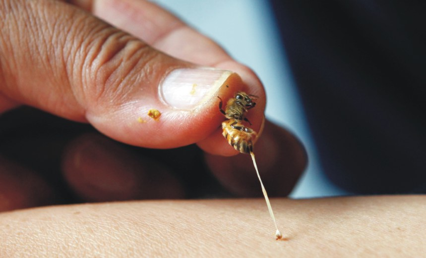 ΔΗΛΗΤΗΡΙΟ ΜΕΛΙΣΣΑΣ 18 Το δηλητήριο της μέλισσας έχει πολλές θεραπευτικές ιδιότητες και στο εξωτερικό χρησιμοποιείται για την παραγωγή σκευασμάτων για να θεραπεύσουν τα αρθριτικά και τις ρευματικές