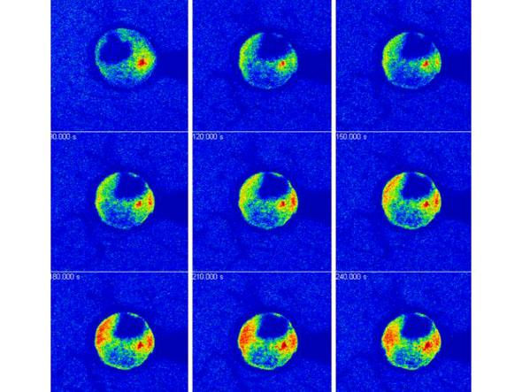 Απεικόνιση του ελεύθερου Ca 2+ Time series tracking calcium release following