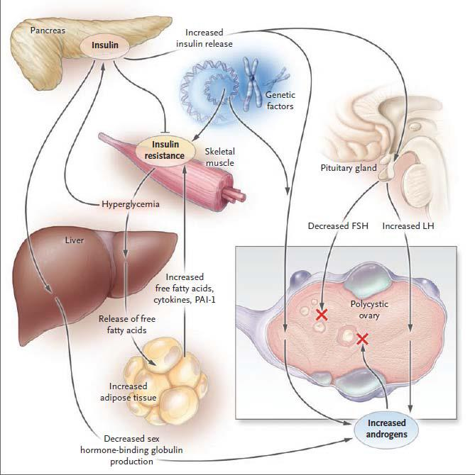 γυναίκες αναπαραγωγικής ηλικίας Αντίσταση στην ινσουλίνη!
