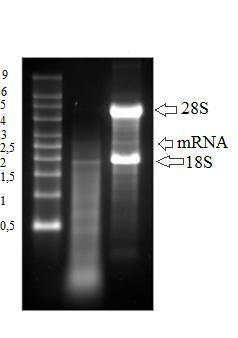 2.2 Ηλεκτροφόρηση ολικού RNA Ηλεκτροφόρηση ακέραιου και αποδομημένου ολικού RNA της NCI-1299 κυτταρικής σειράς όπου παίρνουμε καλύτερη εικόνα και εντοπισμός της ύπαρξης της ζώνης του ολικού mrna που