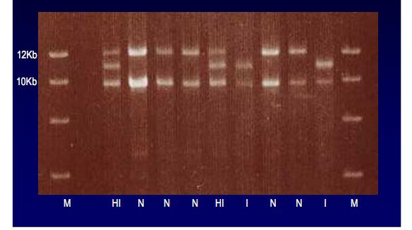 πηκτής σε τράπεζα υπεριώδους ακτινοβολίας και φωτογράφηση των PCR προιόντων (εικόνα 3) Εικόνα 3.