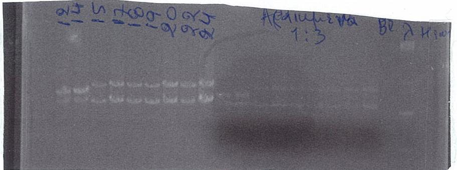 Εικόνα 7 γ Εικόνα 7 δ Εικόνες 7 α,β,γ,δ: Απεικόνιση των προιόντων της PCR του ιντρονίου