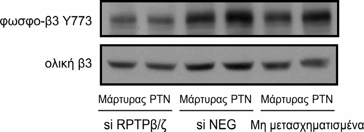 Αποτελέσματα Α Β % φωσφορυλίωση Υ773 της β 3 250 200 150 100 50 *** Μάρτυρας PTN (100 ng/ml) ** 0 si RPTPβ/ζ si NEG Μη μετασχηματισμένα Εικόνα Α25: Επίδραση της αναστολής της έκφρασης του RPTPβ/ζ