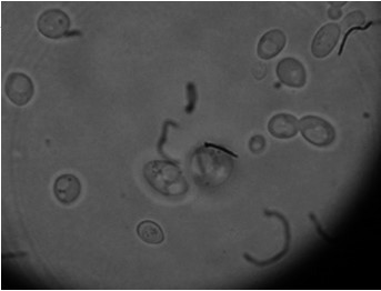 brettanomyces agar περιέχει