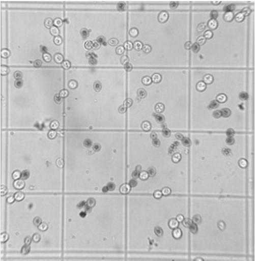 Καταμέτρηση με μικροσκόπιση Μέτρηση ζωντανών κυττάρων ζύμης με μικροσκόπιση Νεκρό Ζωντανό Χρώση με μπλέ του μεθυλενίου Βιβλιογραφία: Κυριώτερες βιβλιογραφικές πηγές: Σουφλερός, Ε. (1997) Οινολογία.