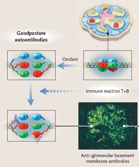 The epitopes for the anti GBM abs are inaccessible unless there is a dissociation of the