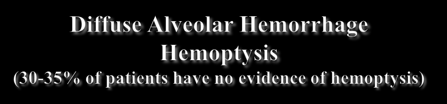 1) chest x-ray - multiple confluent alveolar shadows 2) acute Ht 3) hemorrhagic fluid on BAL, especially if it gets more bloody from the