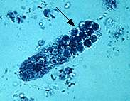 casts and other cellular and