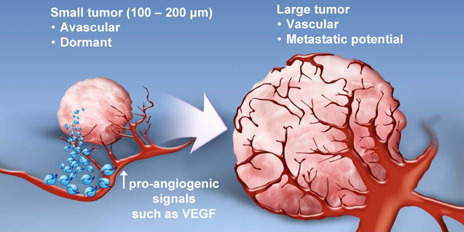 VEGF, vascular endothelial growth factor