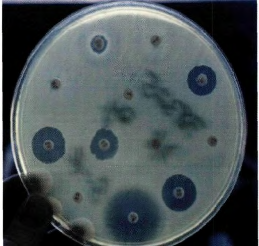 Η δραστικότητα των αντιβιοτικών κατά του μικροβίου που απομονώθηκε από κάποιον ασθενή ελέγχεται με μια εργαστηριακή, μικροβιολογική, τεχνική, το αντιβιόγραμμα (Σχήμα 2.1).