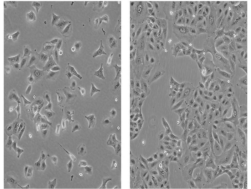 Σχήμα 10: Απεικόνιση υπό στερεοτακτικού μικροσκοπίου κυτταρικής σειράς Α549 σε χαμηλή και υψηλή συγκέντρωση μέσα σε καλλιεργητικό μέσο. Υλικά: 1. Alpha-MEM Medium (Life Technologies cat# 22561-021) 2.