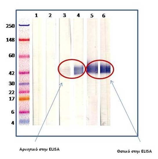 Σχήμα 27: Μέθοδος ανοσοστυπώματος κατά Western. Απεικονίζονται οι λωρίδες, η κάθε μια των οποίων αντιστοιχεί σε διαφορετικό ασθενή.