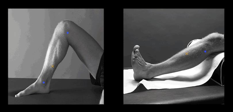 Εικόνα 3 Σημεία τοποθέτησης ηλεκτροδίων καταγραφής σε υποκνημίδιο μυ (αριστερά) και πρόσθιο κνημιαίο μυ (δεξιά) Πηγή φωτογραφίας 1: seniam, Πηγή φωτογραφίας 2: seniam Η απόσταση μεταξύ των κέντρων