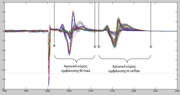 Εικόνα 9 Οριοθέτηση χρονικού εύρους εμφάνισης Μmax και H-reflex.