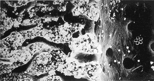 Φλεβικά κολποειδή Καλύπτονται από θυριδωτά ενδοθηλιακά κύτταρα με ασυνεχή βασική μεμβράνη και εξωτερικό υμένα από στρωματικά ή δικτυωτά κύτταρα.