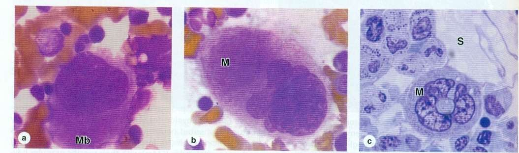 Μεγακαρυοβλάστη Μεγακαρυοβλάστη Μεγακαρυοκύτταρο Μεγακαρυοκύτταρο πλησίον κολποειδούς Προγονική μορφή του μεγακαρυοκυττάρου Μεγάλο κύτταρο με