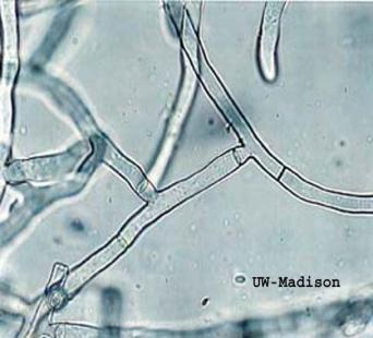 Μύκητες Ευκαρυωτικά (5-10 μm) Κυτταρικό