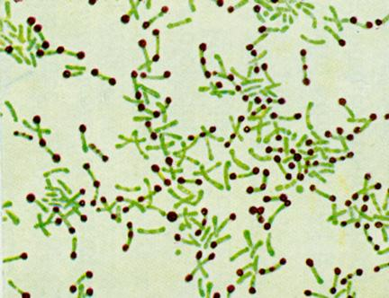 Σχέση των ιών με τα βακτήρια Το Corynobacterium diphtheriae παράγει