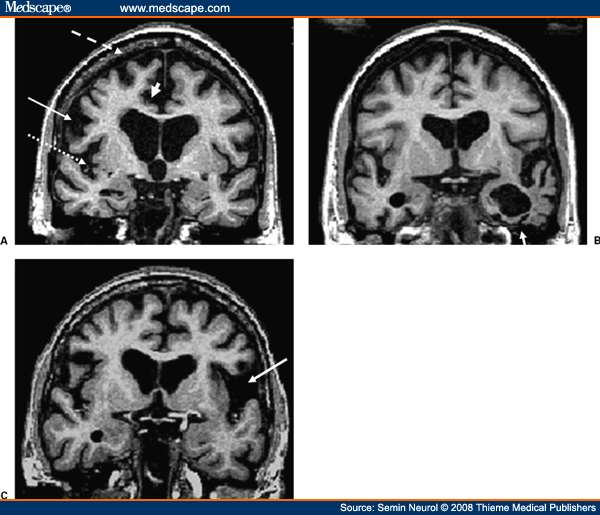 ικανότητα και την κρίση του ιατρού MRI εγκεφάλου: