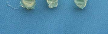 Low-viscosity resin material used for replication of root surfaces The examination in the SEM