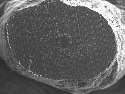 The investigators experienced some difficulties to achieve clear and accurate image in the uncoated samples under the high x100 x200 magnifications, which were overcome with technical imaging