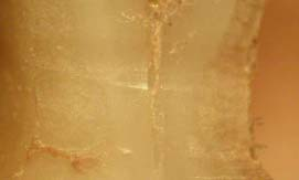 mesiobuccal and