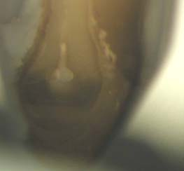 b) stereomicroscope