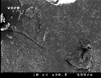 a b Figure 15. Observation of the same root surface under stereomicroscope (a) (x63) and SEM (b) (x30). No isthmus present under stereomicroscope, whereas a partial isthmus was observed under SEM.