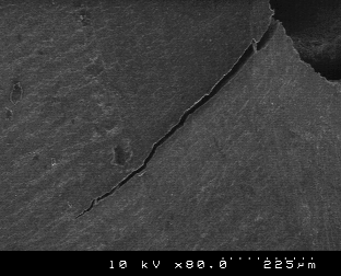 root-end preparation with Surg-1 (group C).
