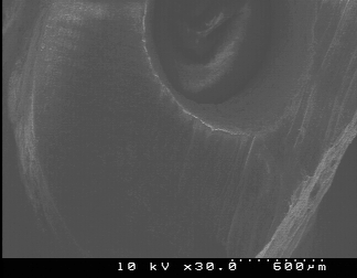 and after root-end preparation with Kis-1