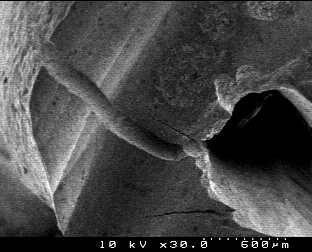application of thin ultrasonic