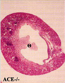 Εικ. 3. Υποπλασία νεφρικών θηλών (Θ) µετά από στοχευµένη µετάλλαξη (ACE-/-) σε ποντίκια.