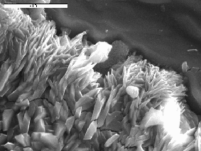 182 α) PFS, r = 0.