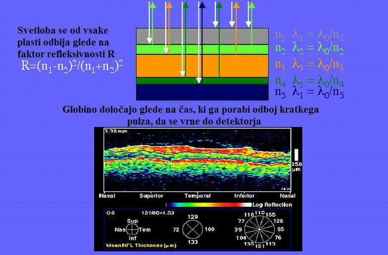 Slika 7: ƒasovno odvisno OCT slikanje, ki analizira strukturo povr²ine koºe v realnem asu.