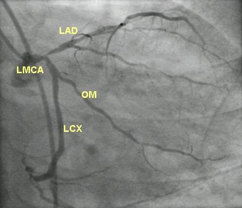 adequacy of perfusion and blood flow
