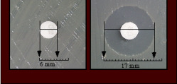 Očitavanje rezultata disk difuzionog metoda antibiograma Zona inhibicije rasta: okrugla zona