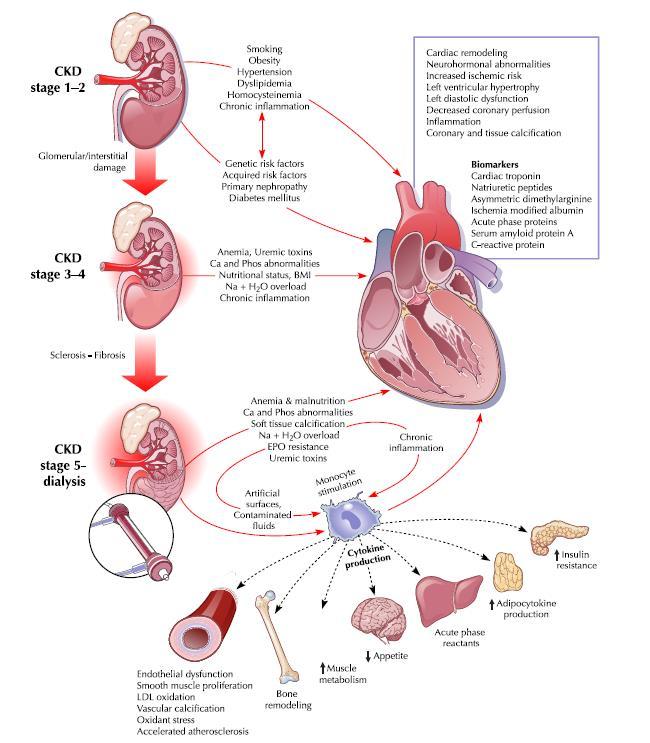Χρόνια Νεφρική Νόσος και Καρδιακή Νόσος