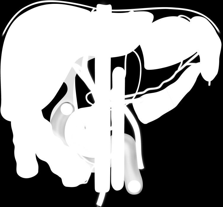 splenic hilum 2 lez cardio- oesophageal 11 along splenic