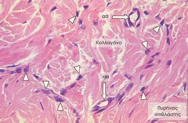 1.2α.Πυκνός ακανόνιστος συνδετικός ιστός Οι δεσμίδες των κολλαγόνων ινών