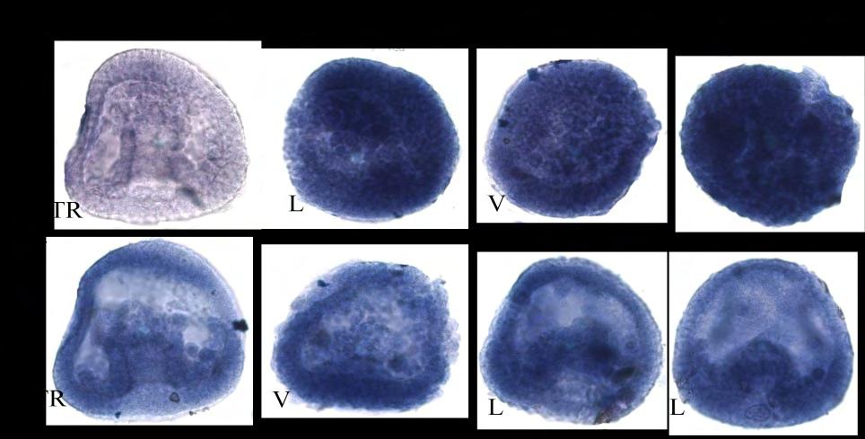 Ανίχνευση της έκφρασης του Coup-TF σε έμβρυα που έχει κατασταλεί ο Six3 Για να ανιχνευθεί η έκφραση του Coup-TF σε έμβρυα που έχει κατασταλεί το γονίδιο six3, πραγματοποιήθηκαν in situ υβριδοποιήσεις