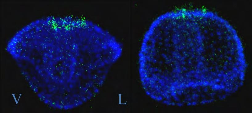 Ανίχνευση της έκφρασης του γονιδίου Fez στο πρόσθιο νευροεξώδερμα. Πραγματοποιήθηκε Fluorescence In situ υβριδοποίηση με αντινοηματικό ιχνηθέτη Fez.