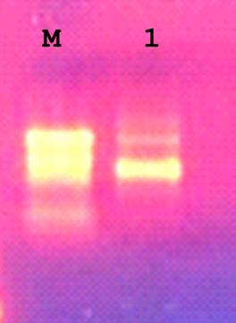 Αλληλεπίδραση του Coup-TF με το γονίδιο FoxQ2 Για να μελετηθεί η αλληλεπίδραση του γονιδίου foxq2 με τον Coup-TF πραγματοποιήθηκαν in situ υβριδοποιήσεις και qprcs.