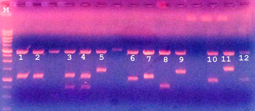 Το μέγεθος του προϊόντος ήταν 1302 bp και πραγματοποιήθηκε RT-PCR με ολικό RNA για την απομόνωση του (εικόνα 75). Ενθέθηκε σε φορέα και συλλέχτηκε από μετασχηματισμένα βακτηριακά κύτταρα.