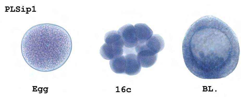 Εικόνα 85: Ηλεκτροφόρηση προϊόντων μετά από in vitro μεταγραφή, Μ: ολικό RNA,Α: αντινοηματικός ιχνηθέτης Ανίχνευση της έκφρασης του γονιδίου Sip1/Zeb2 και