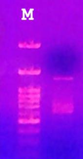 Εικόνα 91: Ηλεκτροφόρηση RT-PCR προϊόντος,μ ; μάρτυρας 1Κb Ενθέθηκε σε φορέα και συλλέχτηκε από μετασχηματισμένα