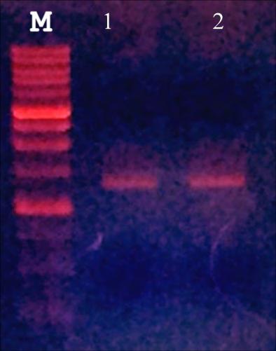Επιλέχθηκε συγκεκριμένα ο κλώνος 9, του οποίου η αλληλουχία βρίσκεται στο παράρτημα, και ακολούθησε PCR σε δύο
